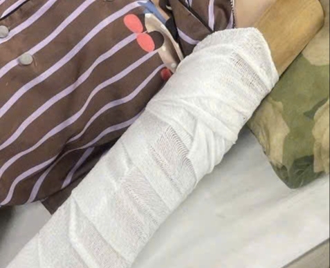 thumb
